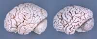 Alzheimer-Forschung: Der Blick ins lebendige Gehirn