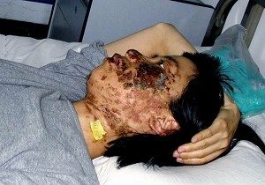 Gao Rongrong wurde durch Elektroschockstäbe im Zwangsarbeitslager Longshan in der Stadt Shenyang verstümmelt – sie starb später an den Folgen der Folter. In Shenyang befindet sich ein Olympiastadion. (faluninfo.net) 
