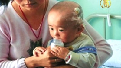 China: Verseuchte Milch verdächtigt Nierensteine bei Kindern zu verursachen