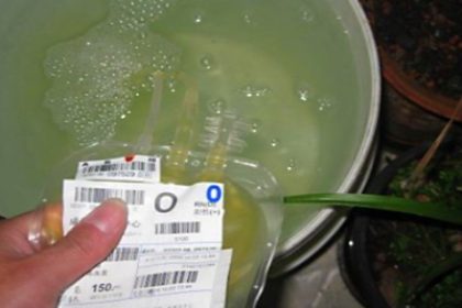 Menschliches Blutplasma als Orchideendünger in China