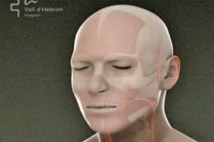 Spain: First Face Transplant Completed