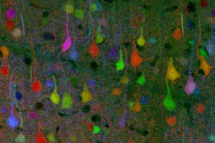 Was Neuronen mit Facebook-Nutzern gemeinsam haben