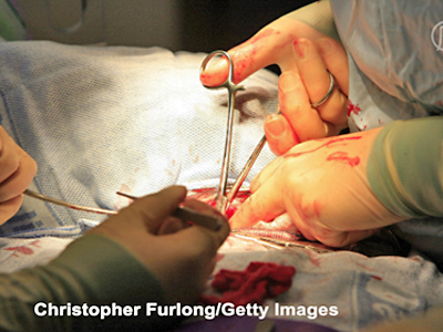Transplantationskongress in Philadelphia, USA: Mediziner verurteilen Organraub in China