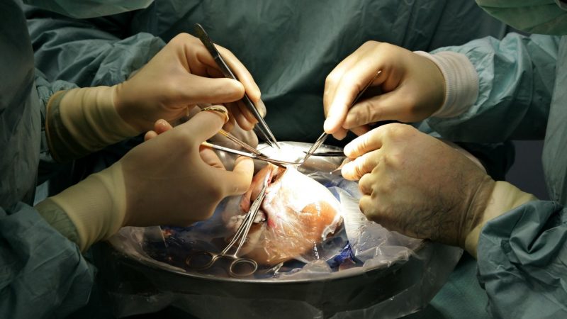 Mitglied des Deutschen Ethikrats bagatellisiert Transplantationsskandal