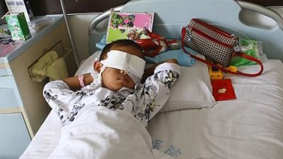 China: Sechsjähriger Junge für immer blind – Augäpfel geraubt!