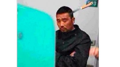 Dieser Chinese spaziert mit Messer im Kopf ins Krankenhaus