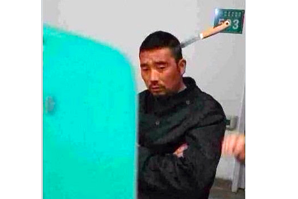 Dieser Chinese spaziert mit Messer im Kopf ins Krankenhaus