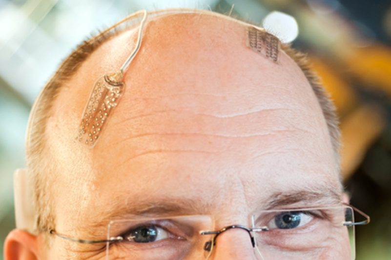 Implantate im Gehirn und Mensch-Maschine-Visionen – Interview
