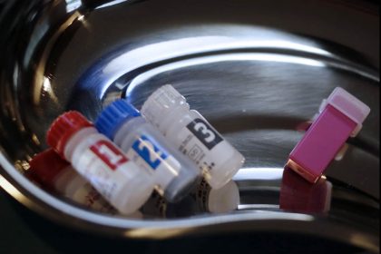 “Gib Todesangst keine Chance!”: Darum sind HIV-Tests gefährlich unzuverlässig
