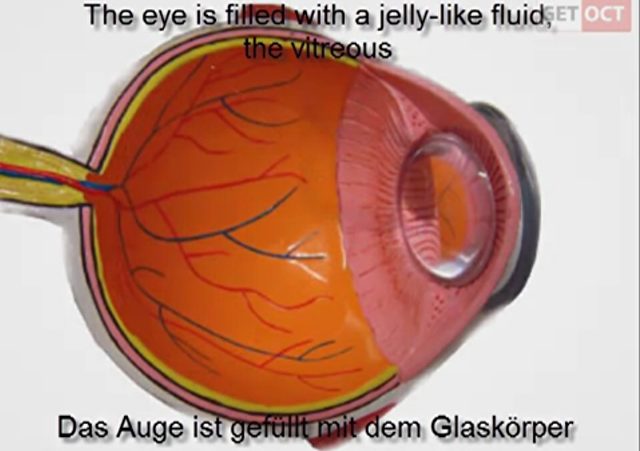 Der Glaskörper des Auges
