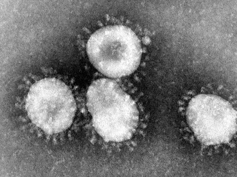 Studie: Mers-Virus wesentlich verbreiteter als gedacht