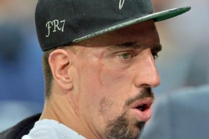 Bayern müssen sich bei Ribéry gedulden
