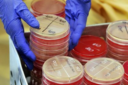 Studie warnt: Mehr Tote durch multiresistente Keime – Gefahr durch Antibiotika