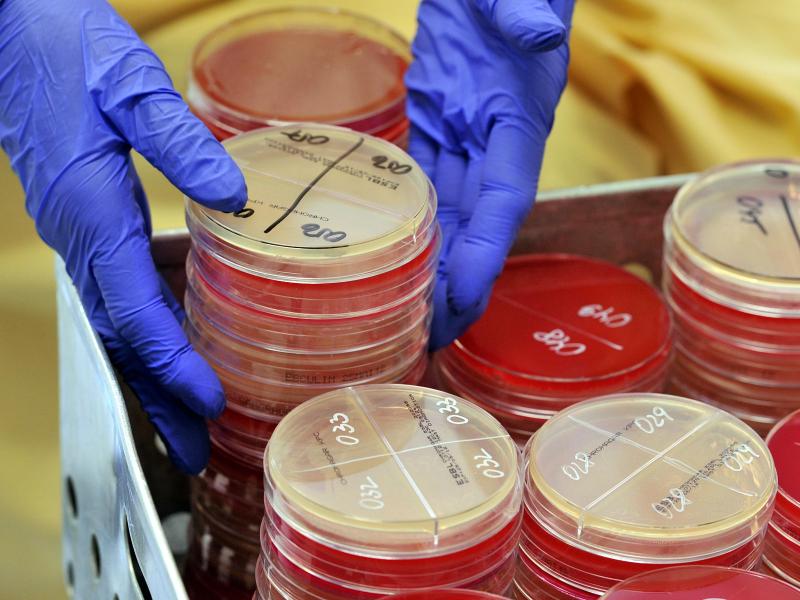 Studie warnt: Mehr Tote durch multiresistente Keime – Gefahr durch Antibiotika