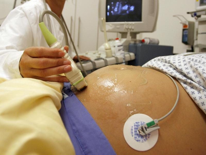 Schwangere lassen sich zu oft untersuchen: Experten besorgt