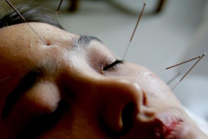 Schulterschmerzen? Das ist der Wunder-Akupunkturpunkt der TCM