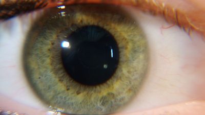 Irisdiagnostik: Das Auge – mehr als der Sitz der Seele