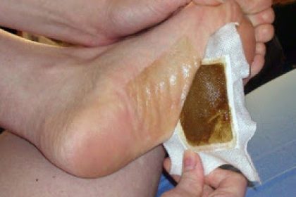 Genial: Dieses einfache Fußpflaster entgiftet über Nacht