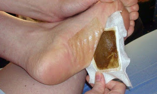 Genial: Dieses einfache Fußpflaster entgiftet über Nacht