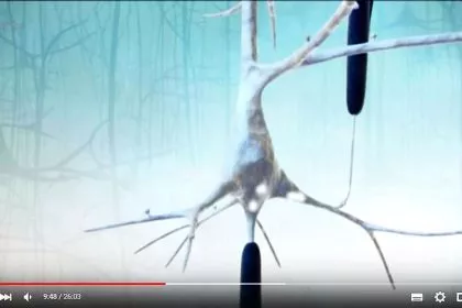 Du simulierst doch nur! Leben mit Multipler Sklerose (+VIDEO)