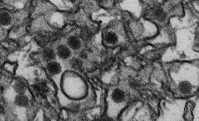 Erste sexuelle Übertragung von Zikavirus in Deutschland
