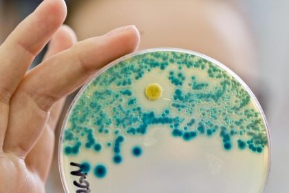 Viele Klinikpatienten bringen multiresistente Keime mit
