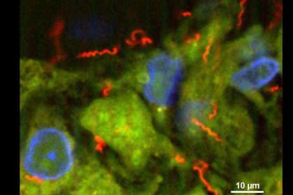 Großstadt-Phänomen: Neuer Höchststand bei Syphilis-Diagnosen