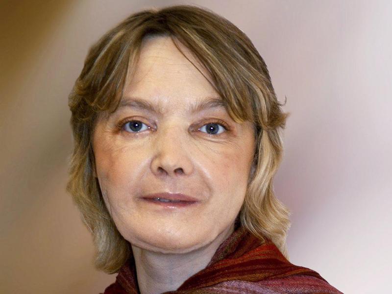 Erste Frau mit transplantiertem Gesicht gestorben – „Extrem komplexer Eingriff”