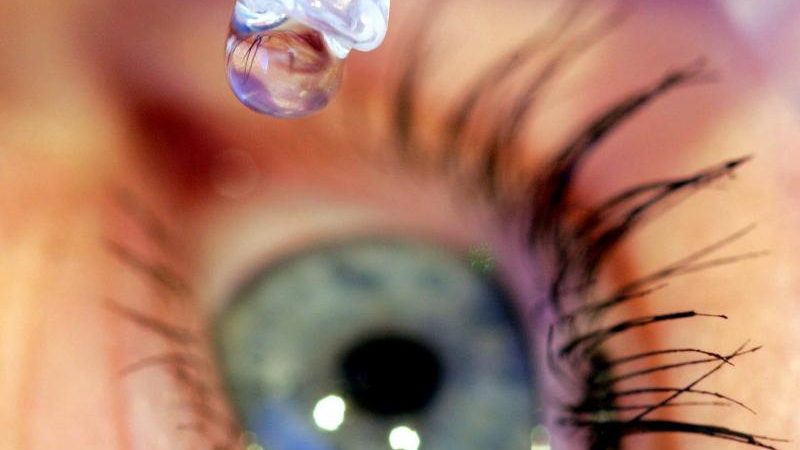 Augengrippe breitet sich in Bonn schnell aus