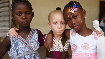 Afrikanische Albinos tragen ihren ersten Schönheitswettbewerb aus