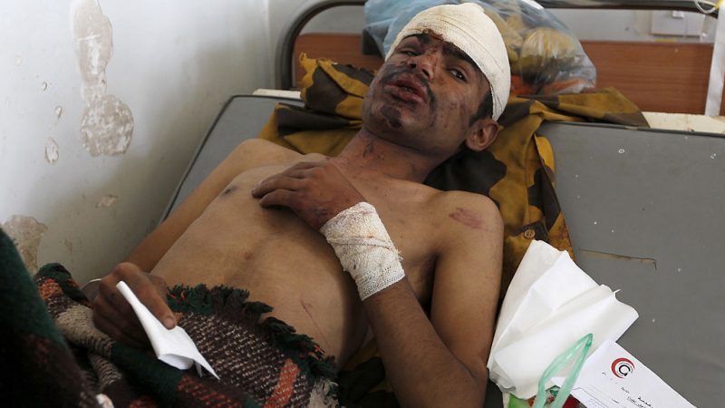 Nach Saudi-Bombardements auf Trauerfeier: UNO verkündet 72-stündige Waffenruhe für den Jemen