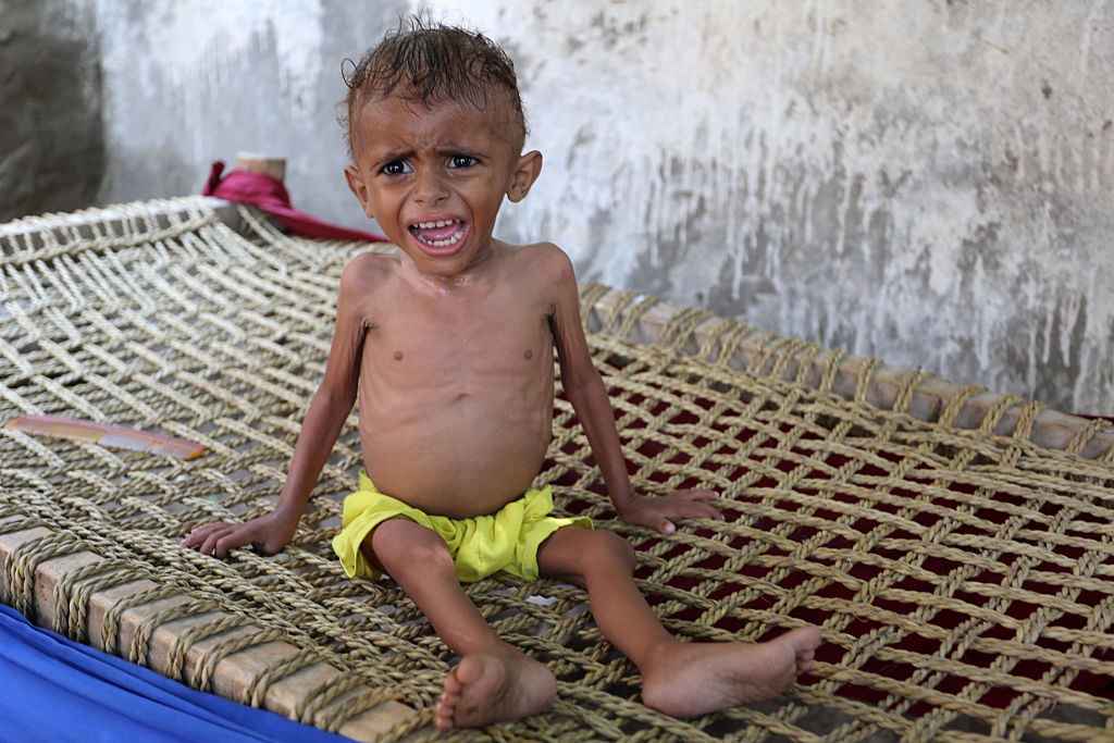 Cholera und Hungersnot – UNO: Konfliktparteien im Jemen setzen Nahrung als „Kriegswaffe“ ein