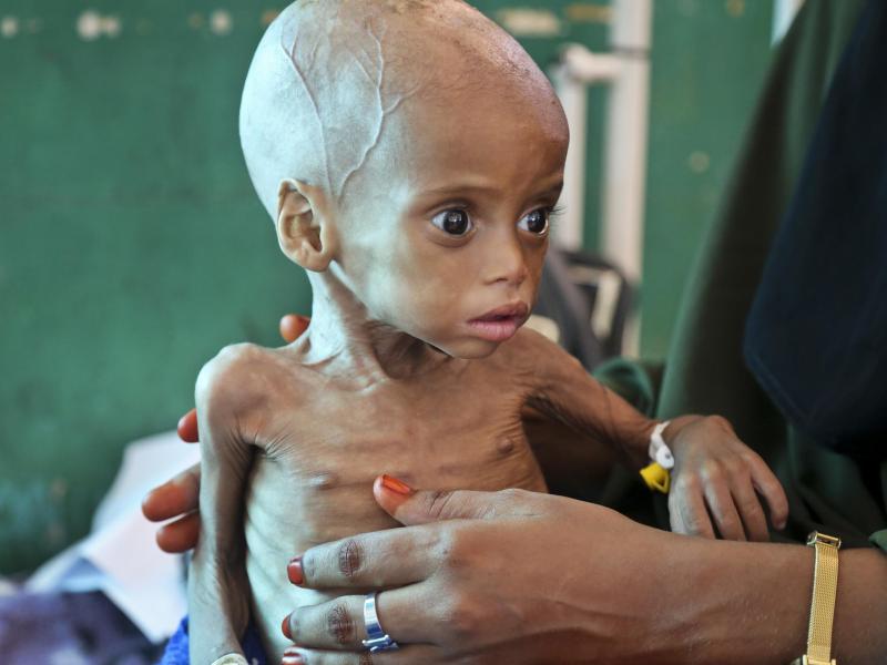 UNO- und EU-Bericht: Bis zu 108 Millionen Menschen waren 2016 vom Hungertod bedroht