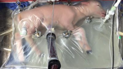 Künstliche Gebärmutter: Rettet diese Maschine eines Tages Babys? (+VIDEO)