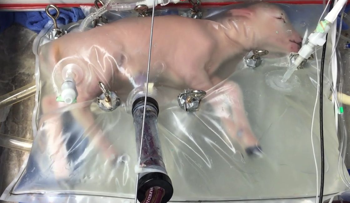 Künstliche Gebärmutter: Rettet diese Maschine eines Tages Babys? (+VIDEO)