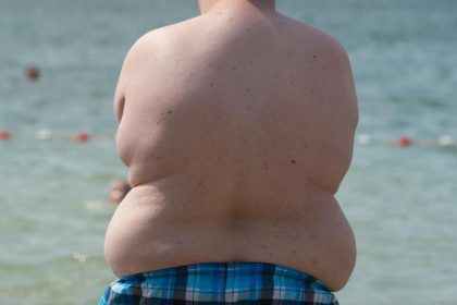 Jedes siebte Kind in Deutschland zu dick oder sogar fettleibig