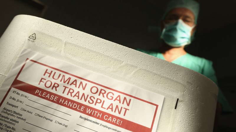 Schweiz: Jeder soll zum Organspender werden – außer er lehnt das zu Lebzeiten ab