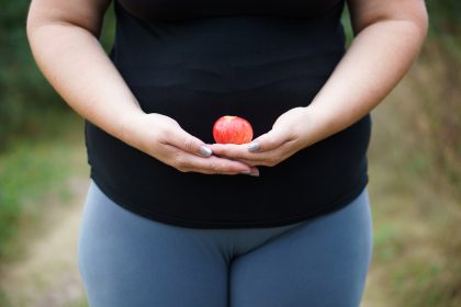 450 Kilogramm schwere Frau verlor 360 Kilogramm nach dramatischen Ereignissen