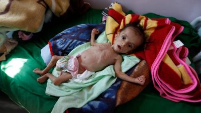 14 Millionen Menschen von Hungersnot bedroht: Müller wirft Weltgemeinschaft Versagen im Jemen vor