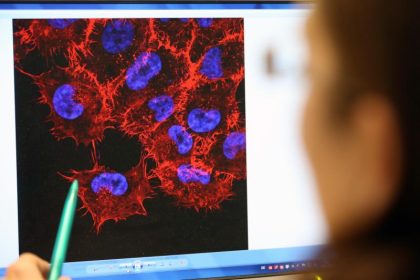 Neue Studie: Erhöhte Krebsraten nach COVID-19-Impfungen