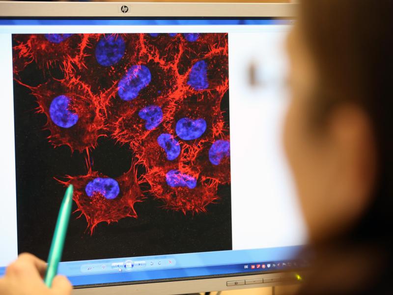Neue Studie: Erhöhte Krebsraten nach COVID-19-Impfungen
