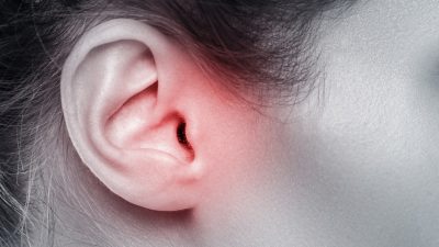 Chinesische Medizin und Tinnitus – Was haben Ohrenprobleme mit den Nieren zu tun?