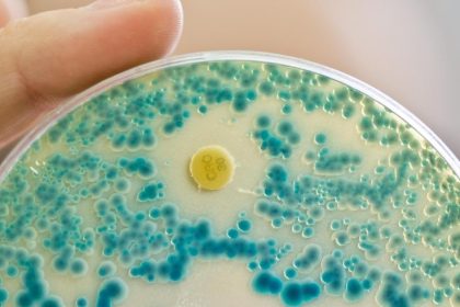 Antibiotika-resistente Keime in Gewässern: Experten besorgt