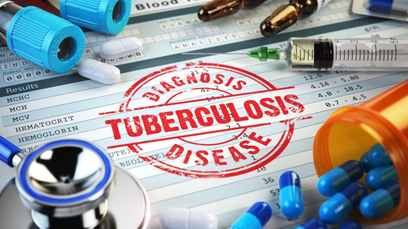 Ist die Angst vor eingeschleppter Tuberkulose berechtigt?