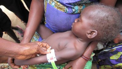 Unicef: 770.000 Kinder im Kongo unterernährt