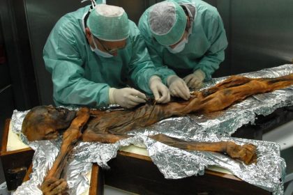 Neue Studie: Darmflora von Gletschermumie Ötzi zeigt, wie ungesund unsere Ernährung ist