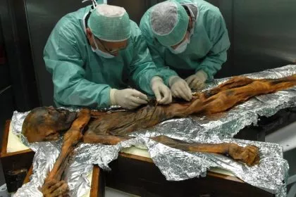 Neue Studie: Darmflora von Gletschermumie Ötzi zeigt, wie ungesund unsere Ernährung ist