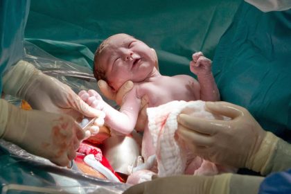 Türkei: Geplante Kaiserschnitte in privaten Kliniken künftig verboten