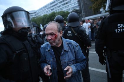 Grüne zu Ausschreitungen von Chemnitz: Seehofer hat “Legitimationsbasis für einen rechten Mob” geschaffen