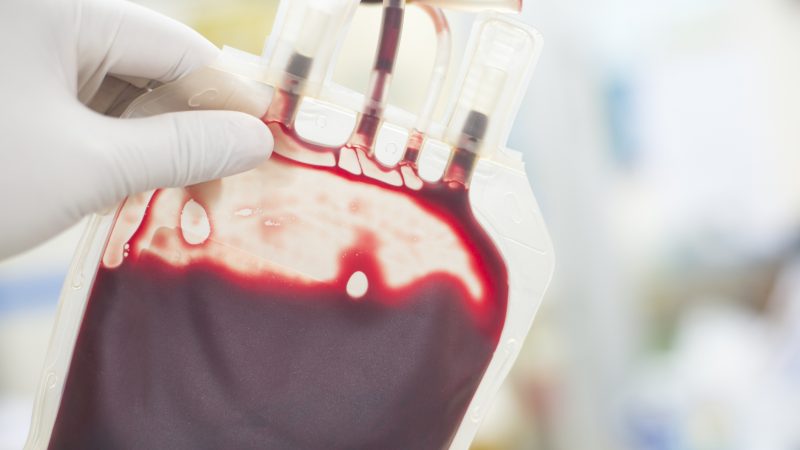Tropenmediziner: Sicherheit von Blutspenden neu diskutieren